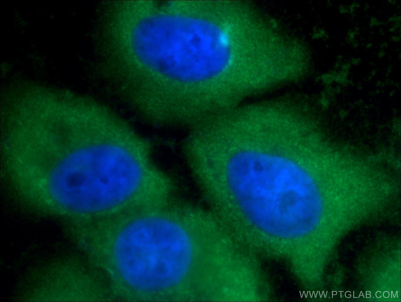 Immunofluorescence (IF) / fluorescent staining of A431 cells using Annexin A1 Polyclonal antibody (21990-1-AP)