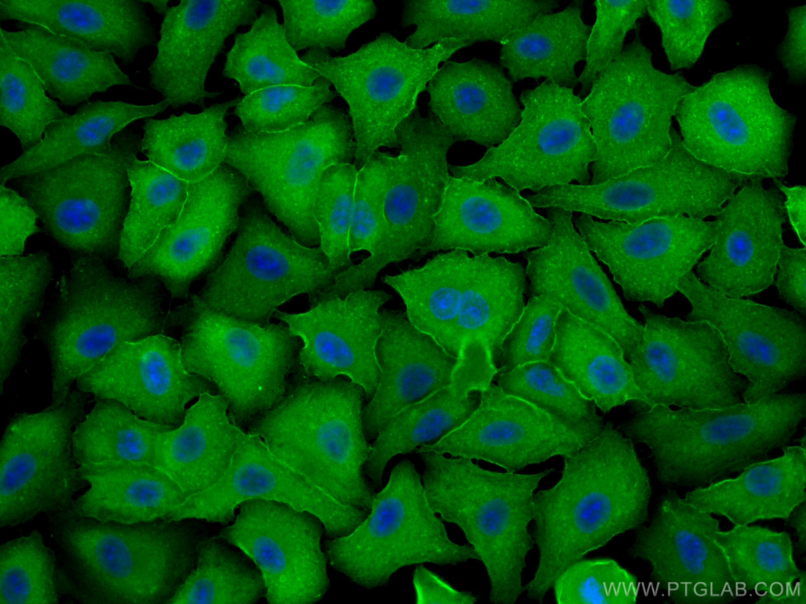 Immunofluorescence (IF) / fluorescent staining of A549 cells using Annexin A1 Polyclonal antibody (21990-1-AP)