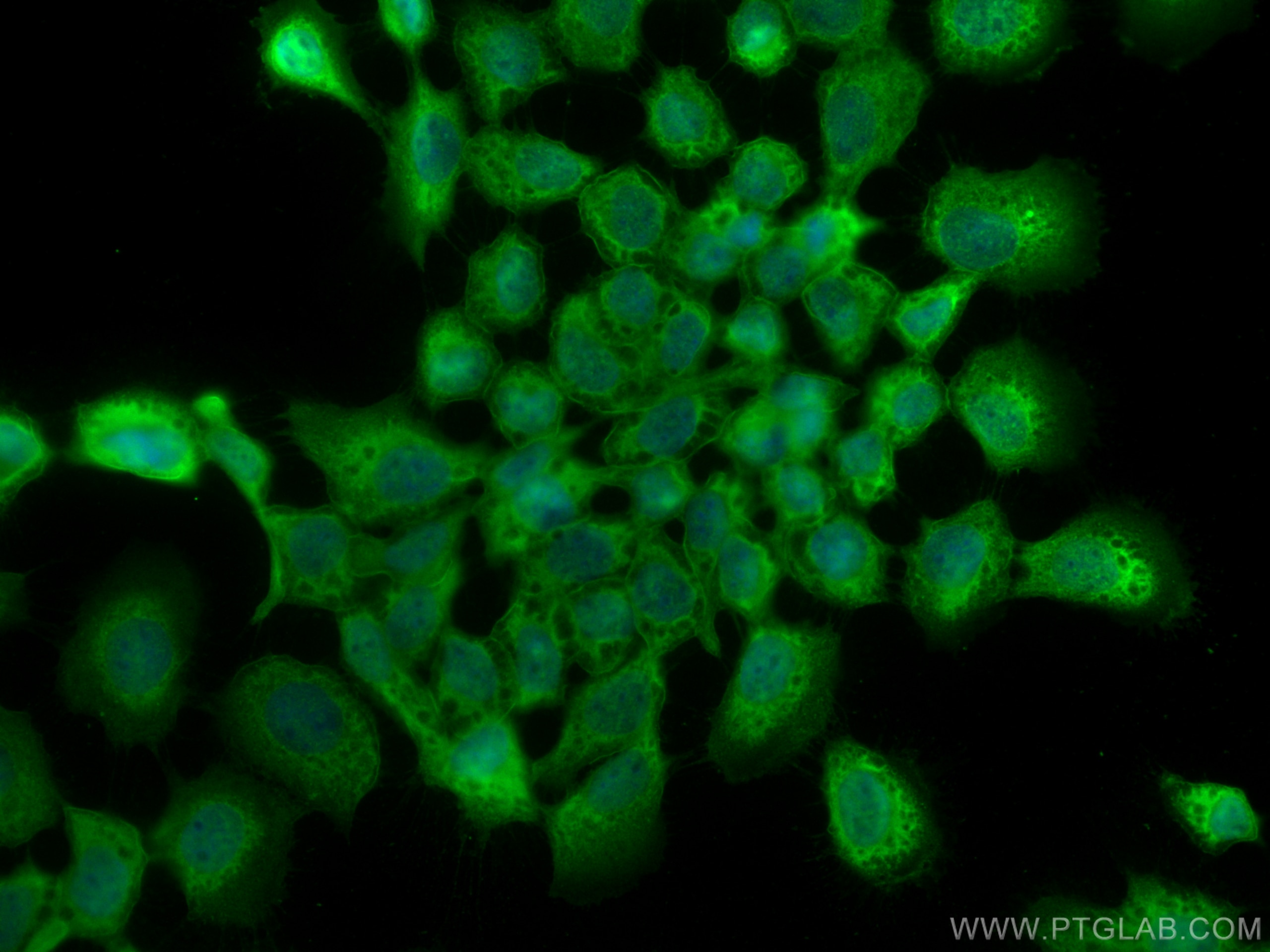Immunofluorescence (IF) / fluorescent staining of A431 cells using Annexin A1 Polyclonal antibody (21990-1-AP)