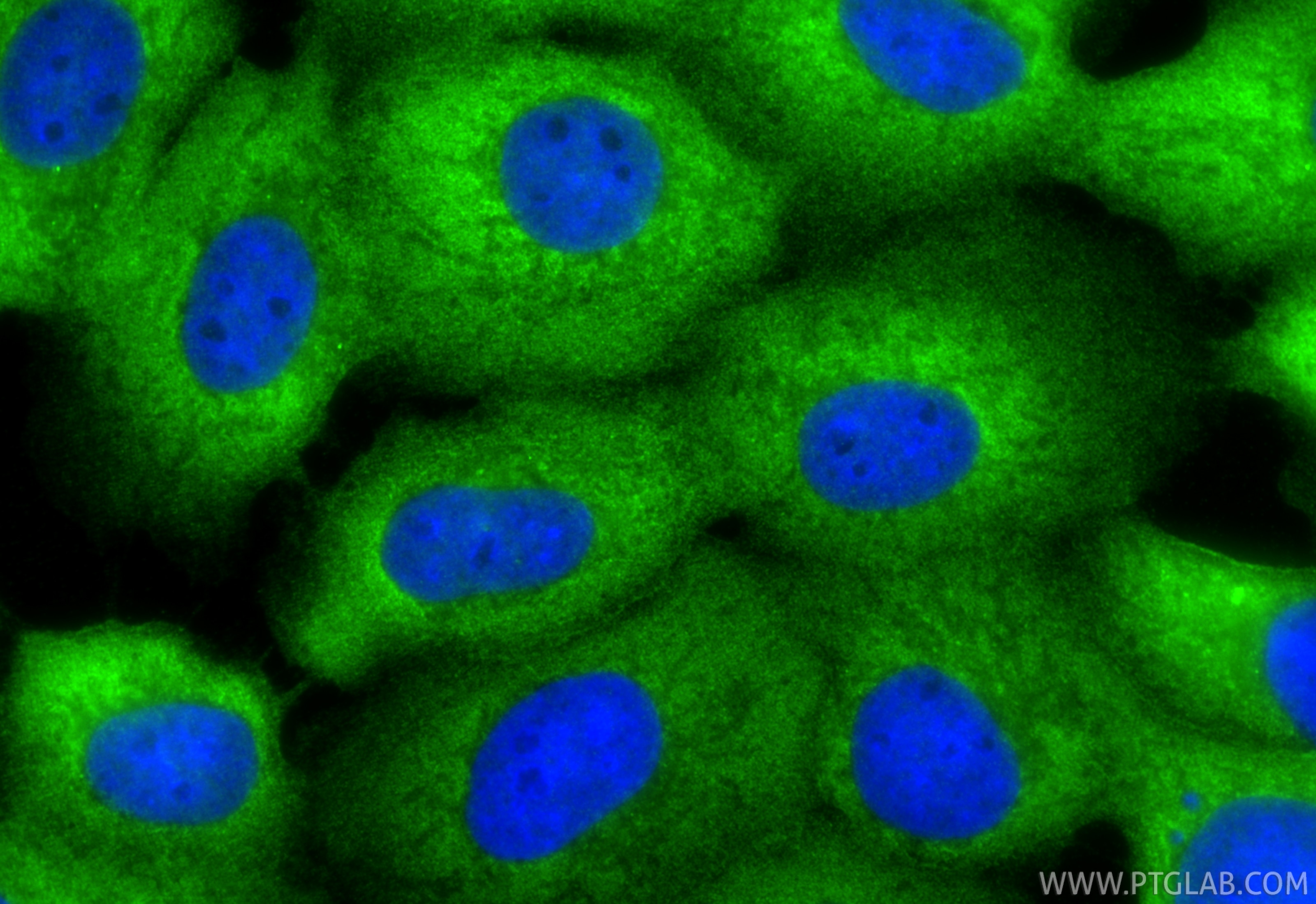Immunofluorescence (IF) / fluorescent staining of A431 cells using Annexin A1 Polyclonal antibody (21990-1-AP)