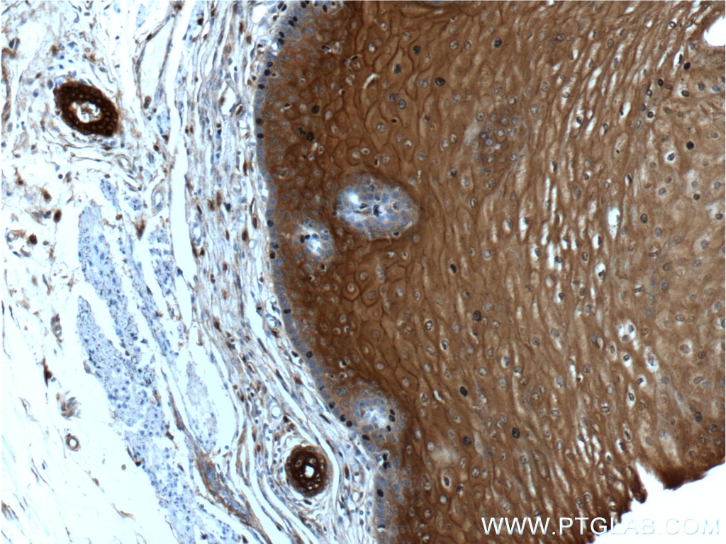 Immunohistochemistry (IHC) staining of human oesophagus tissue using Annexin A1 Polyclonal antibody (21990-1-AP)