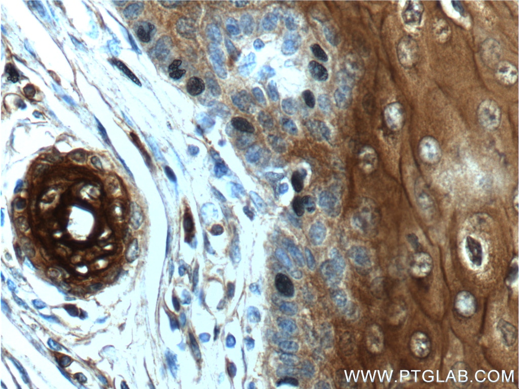 Immunohistochemistry (IHC) staining of human oesophagus tissue using Annexin A1 Polyclonal antibody (21990-1-AP)