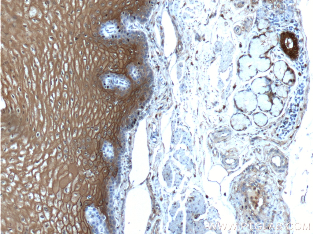 Immunohistochemistry (IHC) staining of human oesophagus tissue using Annexin A1 Polyclonal antibody (21990-1-AP)