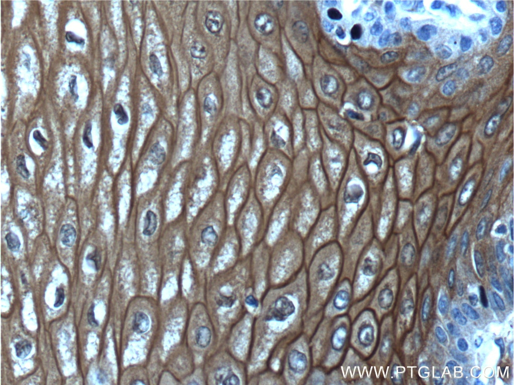 IHC staining of human oesophagus using 21990-1-AP