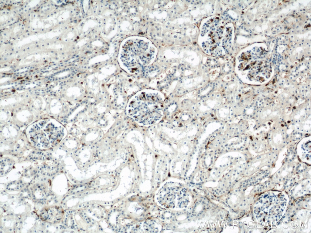 Immunohistochemistry (IHC) staining of human kidney tissue using Annexin A1 Polyclonal antibody (21990-1-AP)