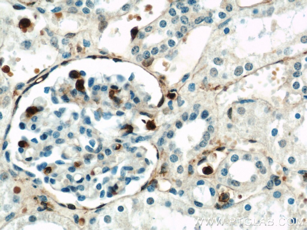 Immunohistochemistry (IHC) staining of human kidney tissue using Annexin A1 Polyclonal antibody (21990-1-AP)