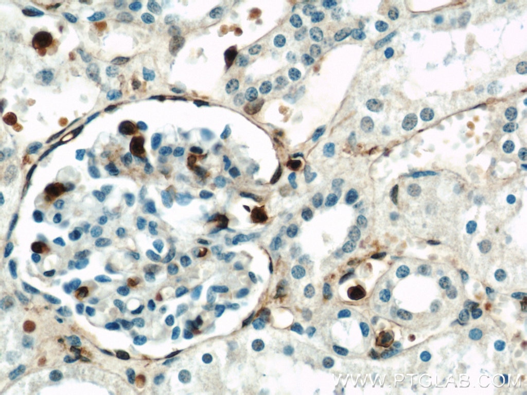 IHC staining of human kidney using 21990-1-AP