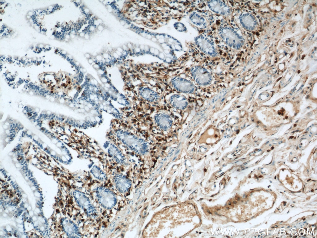Immunohistochemistry (IHC) staining of human small intestine tissue using Annexin A1 Polyclonal antibody (21990-1-AP)