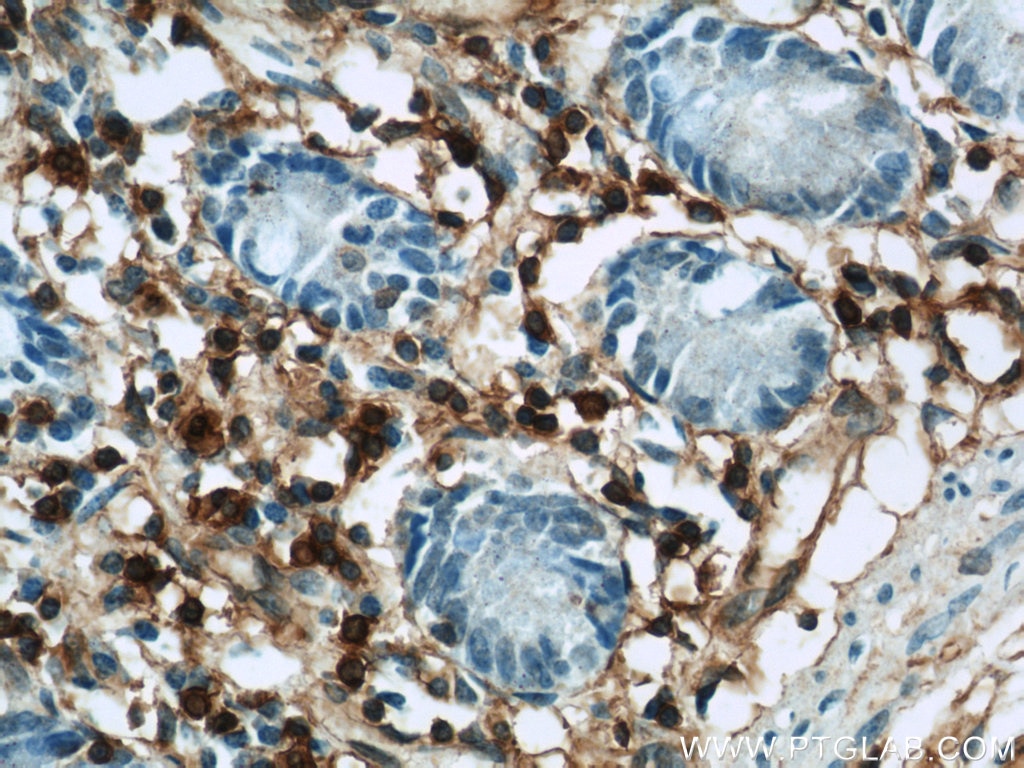 Immunohistochemistry (IHC) staining of human small intestine tissue using Annexin A1 Polyclonal antibody (21990-1-AP)