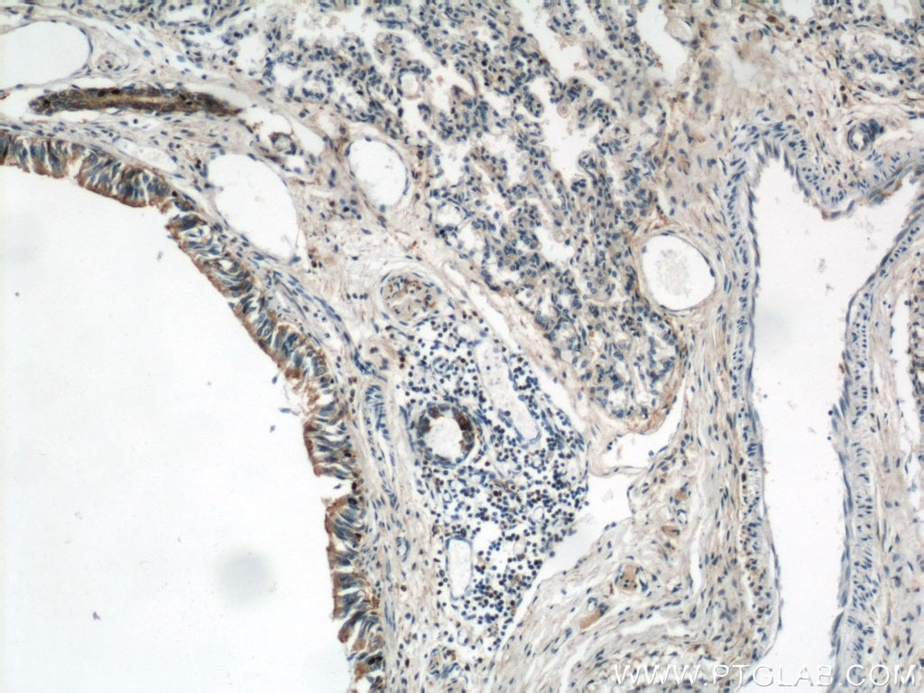 Immunohistochemistry (IHC) staining of human lung tissue using Annexin A1 Polyclonal antibody (21990-1-AP)