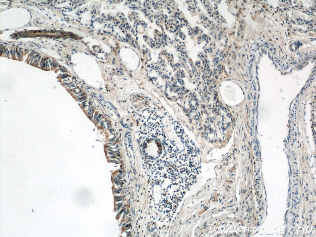 IHC staining of human lung using 21990-1-AP