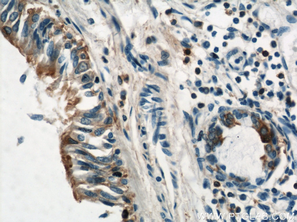 Immunohistochemistry (IHC) staining of human lung tissue using Annexin A1 Polyclonal antibody (21990-1-AP)