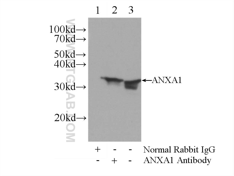 Immunoprecipitation (IP) experiment of HeLa cells using Annexin A1 Polyclonal antibody (21990-1-AP)
