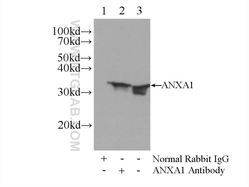 IP experiment of HeLa using 21990-1-AP