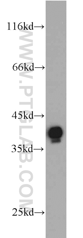 Western Blot (WB) analysis of MDA-MB-453s cells using Annexin A1 Polyclonal antibody (21990-1-AP)