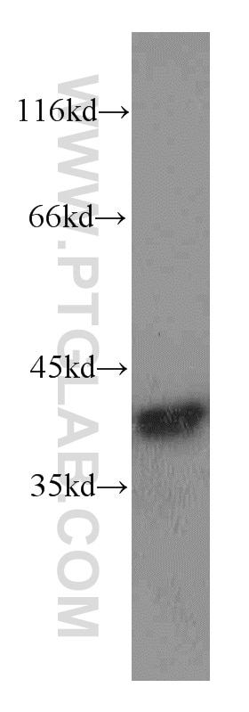 Western Blot (WB) analysis of HepG2 cells using Annexin A1 Polyclonal antibody (21990-1-AP)