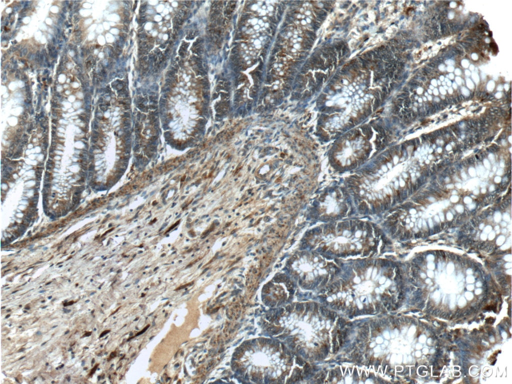 Immunohistochemistry (IHC) staining of human colon tissue using Annexin A1 Polyclonal antibody (55018-1-AP)