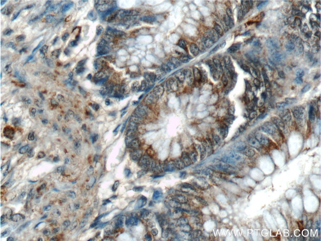 Immunohistochemistry (IHC) staining of human colon tissue using Annexin A1 Polyclonal antibody (55018-1-AP)