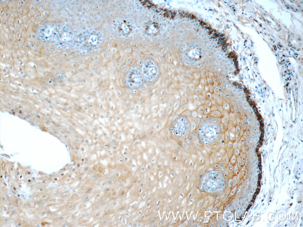 Immunohistochemistry (IHC) staining of human oesophagus tissue using Annexin A1 Polyclonal antibody (55018-1-AP)