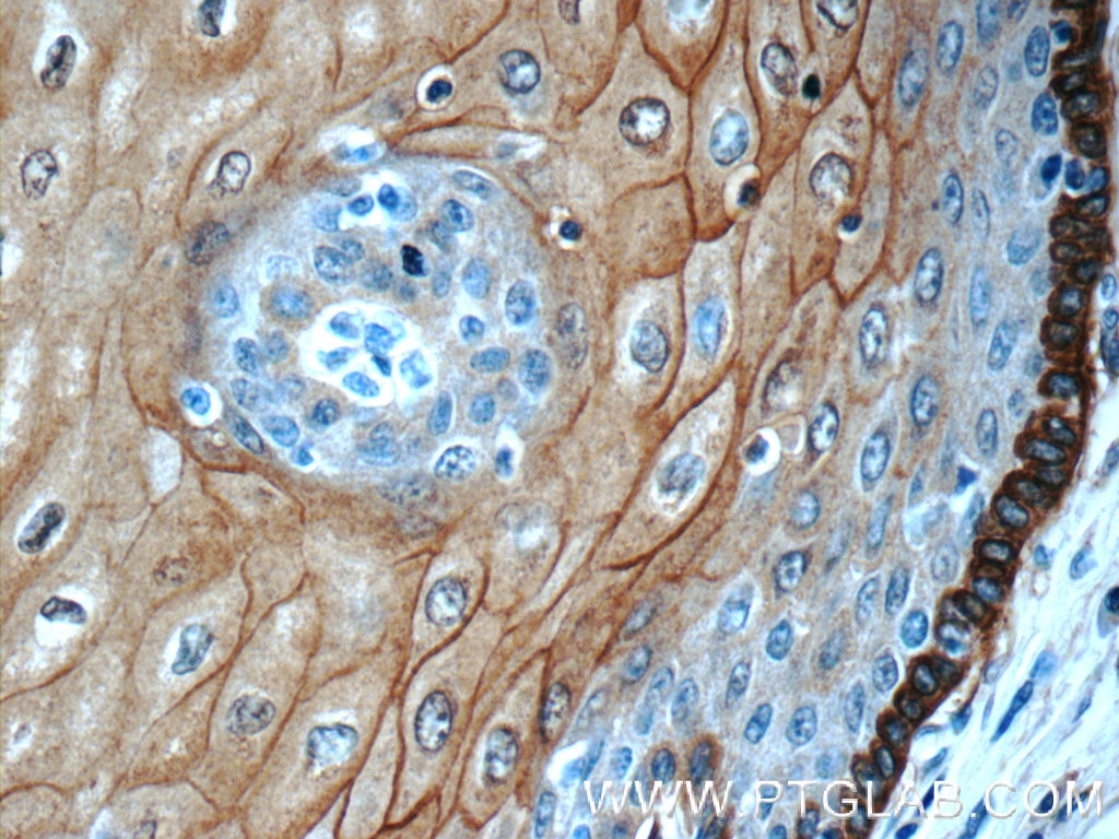 Immunohistochemistry (IHC) staining of human oesophagus tissue using Annexin A1 Polyclonal antibody (55018-1-AP)