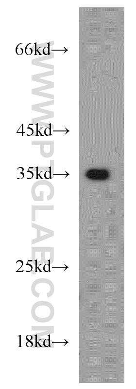 Western Blot (WB) analysis of HeLa cells using Annexin A1 Polyclonal antibody (55018-1-AP)