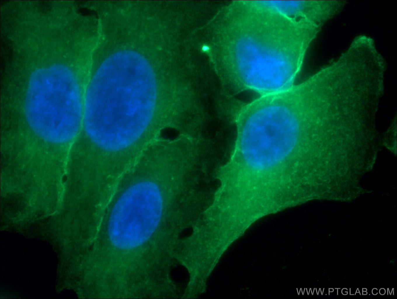 Immunofluorescence (IF) / fluorescent staining of A549 cells using Annexin A1 Monoclonal antibody (66344-1-Ig)