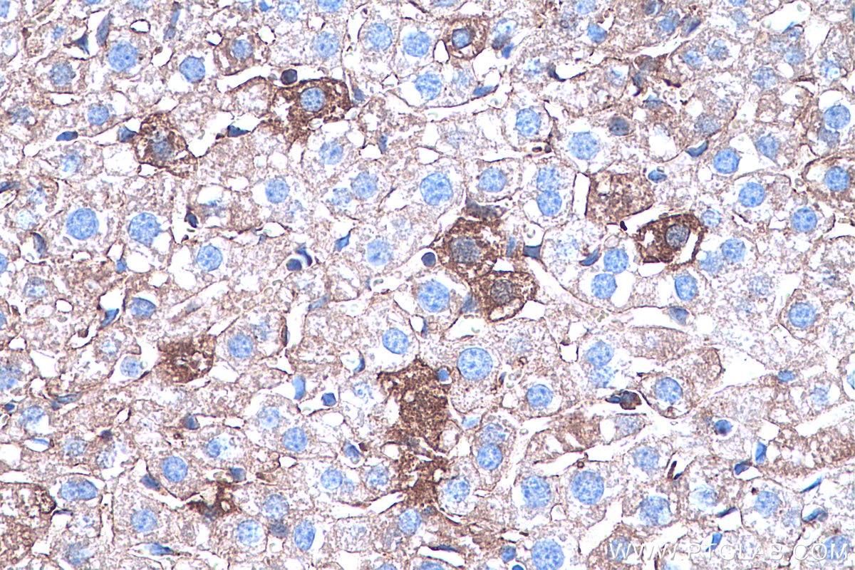 IHC staining of mouse liver using 66344-1-Ig