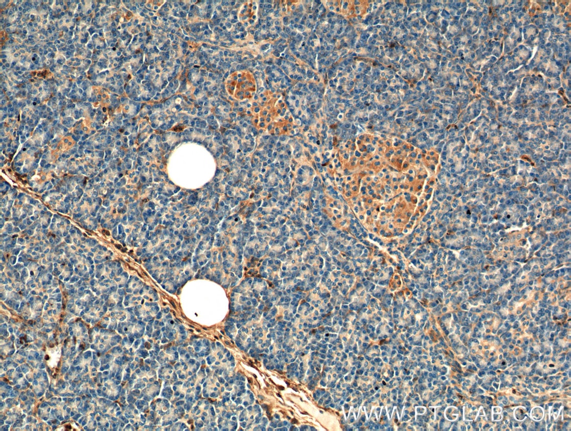 IHC staining of human pancreas using 66344-1-Ig