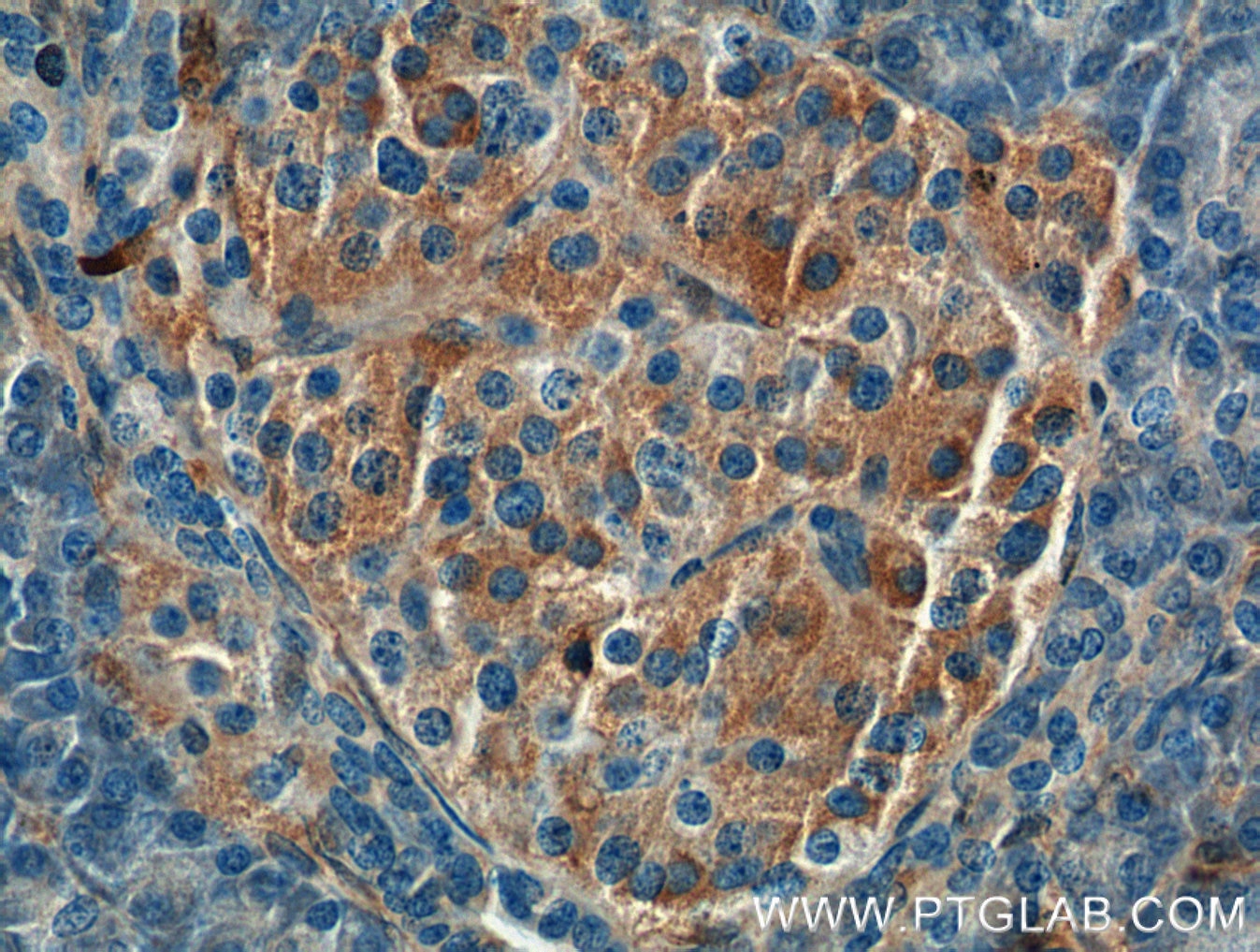 IHC staining of human pancreas using 66344-1-Ig