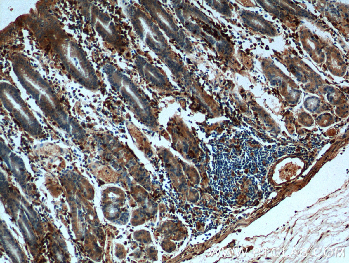 Immunohistochemistry (IHC) staining of human stomach tissue using Annexin A1 Monoclonal antibody (66344-1-Ig)