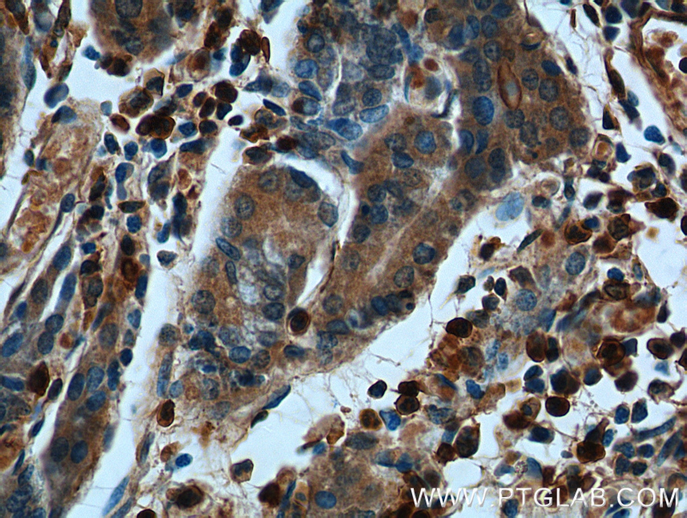 Immunohistochemistry (IHC) staining of human stomach tissue using Annexin A1 Monoclonal antibody (66344-1-Ig)