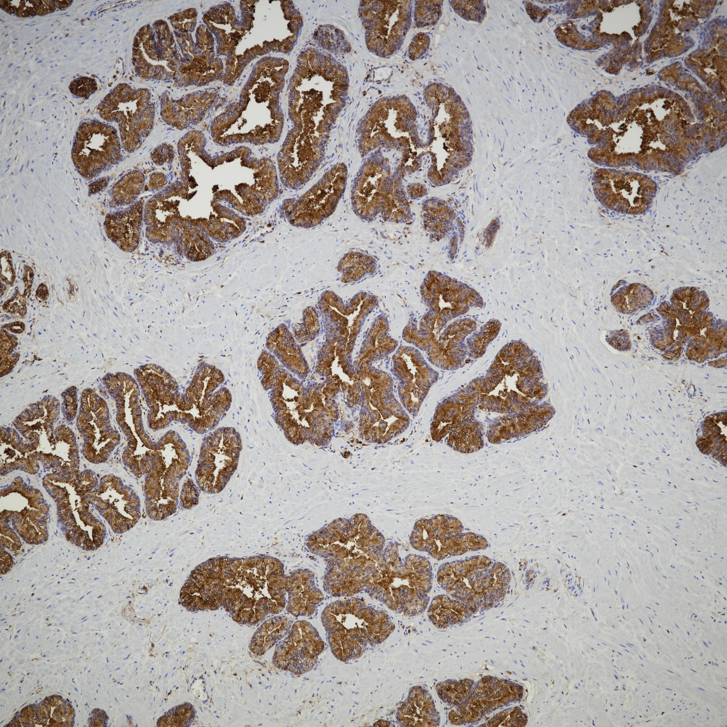 Immunohistochemistry (IHC) staining of human prostate tissue using Annexin A1 Monoclonal antibody (66344-1-Ig)