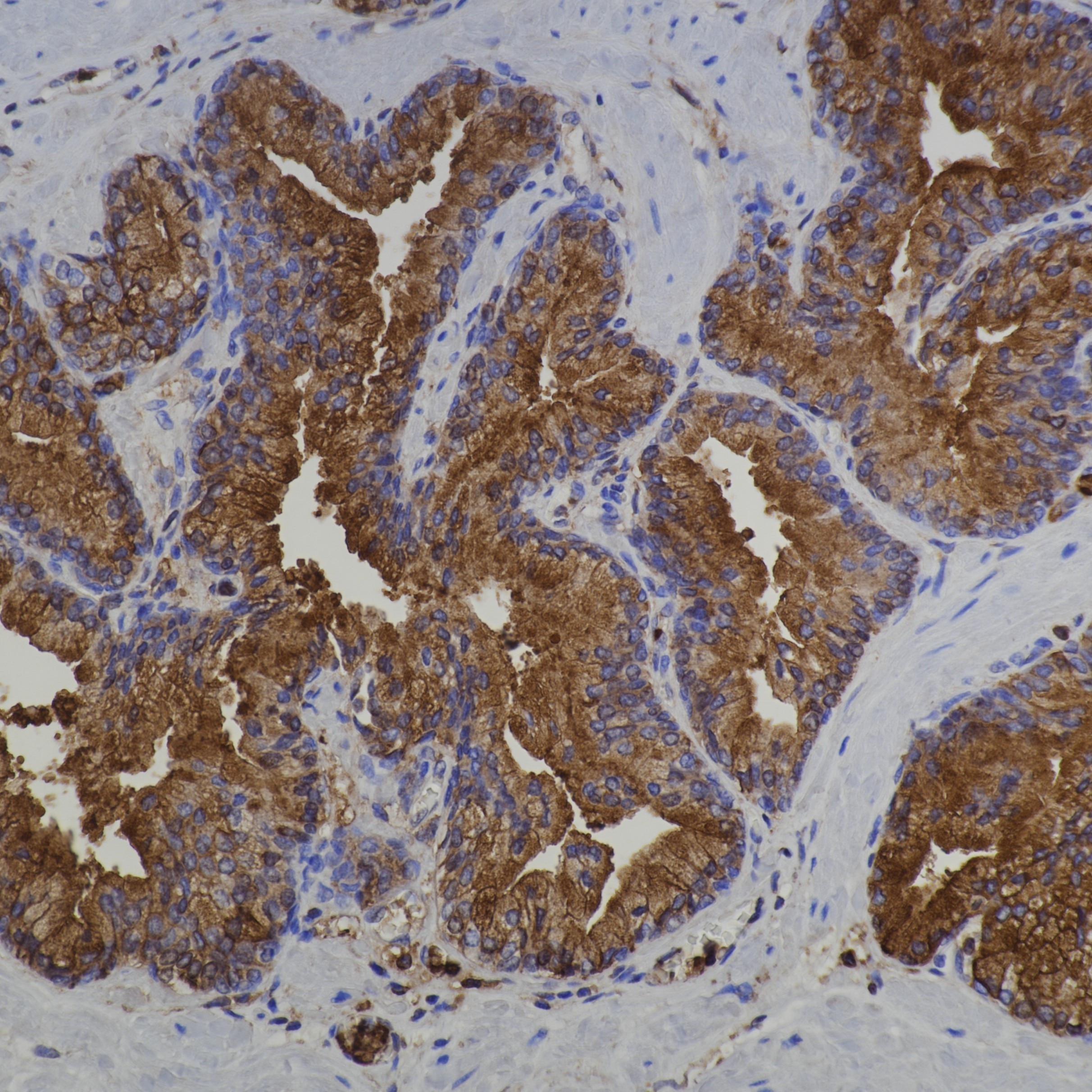 Immunohistochemistry (IHC) staining of human prostate tissue using Annexin A1 Monoclonal antibody (66344-1-Ig)