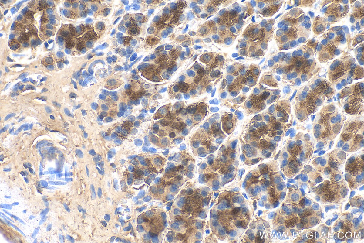 Immunohistochemistry (IHC) staining of rat stomach tissue using ANXA10 Polyclonal antibody (27783-1-AP)
