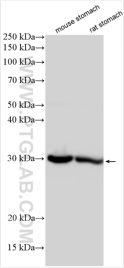 ANXA10