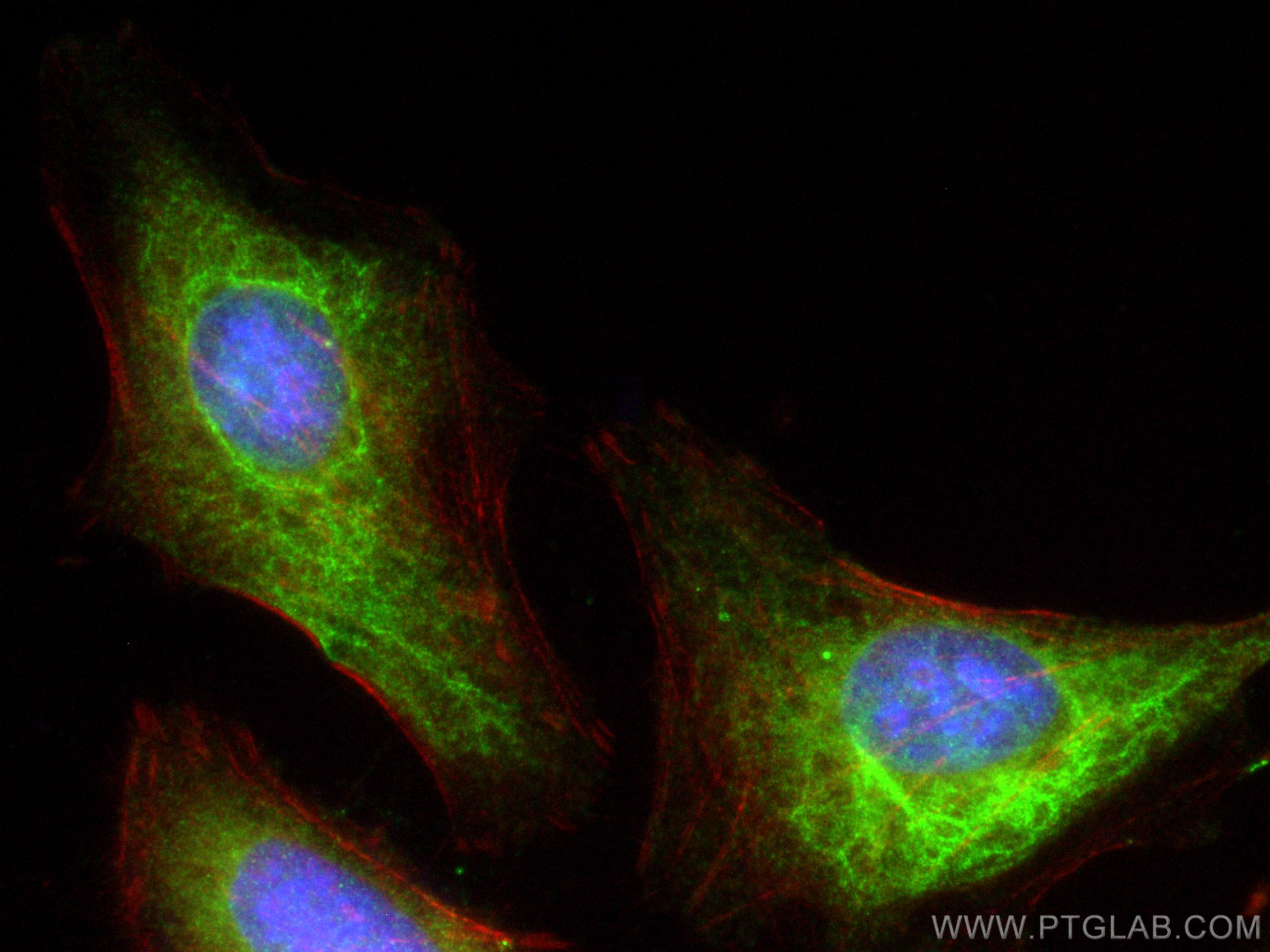 Immunofluorescence (IF) / fluorescent staining of HeLa cells using Annexin A11 Polyclonal antibody (10479-2-AP)