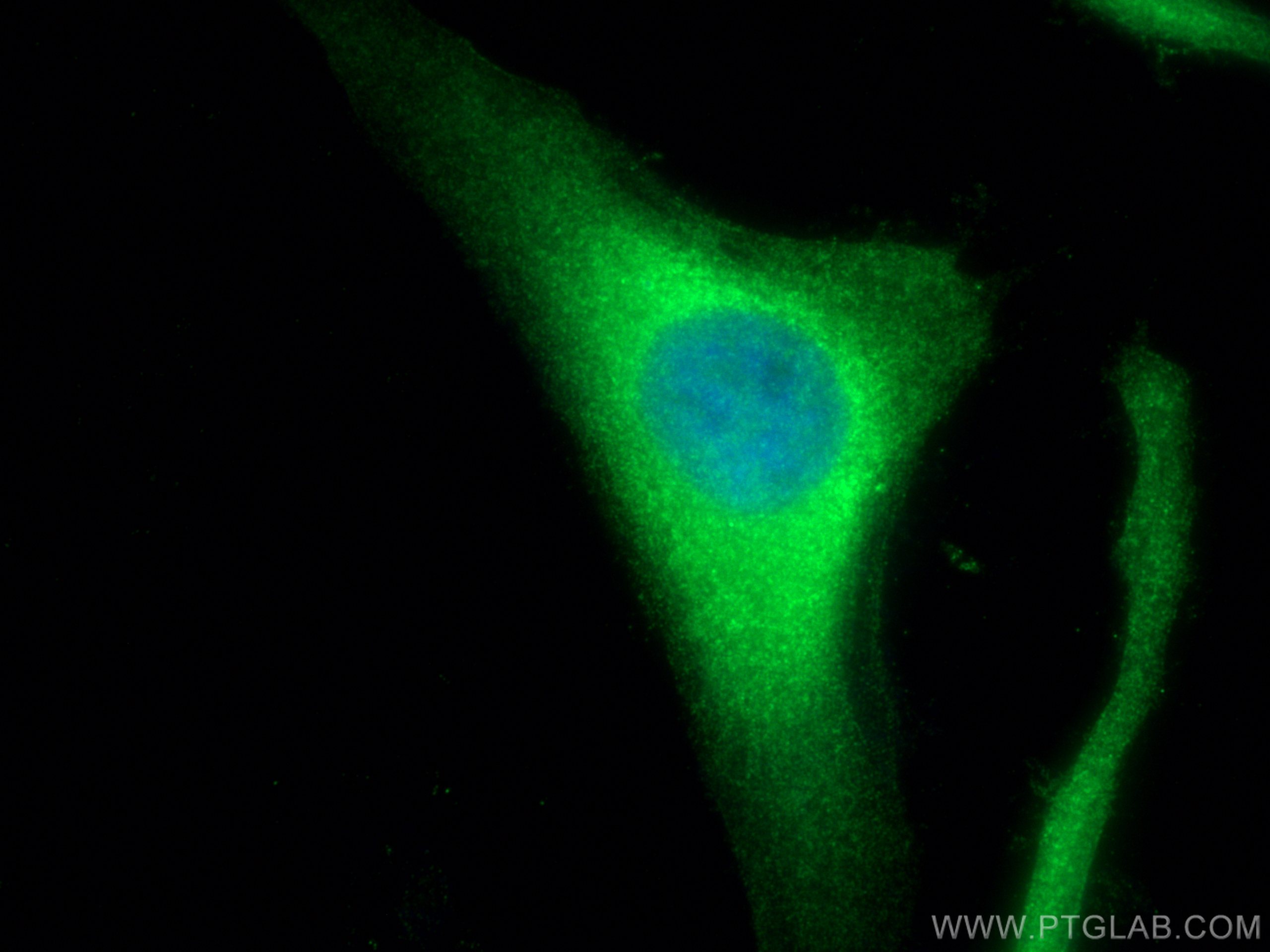Immunofluorescence (IF) / fluorescent staining of HeLa cells using Annexin A11 Polyclonal antibody (10479-2-AP)