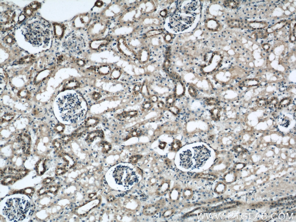 Immunohistochemistry (IHC) staining of human kidney tissue using Annexin A11 Polyclonal antibody (10479-2-AP)