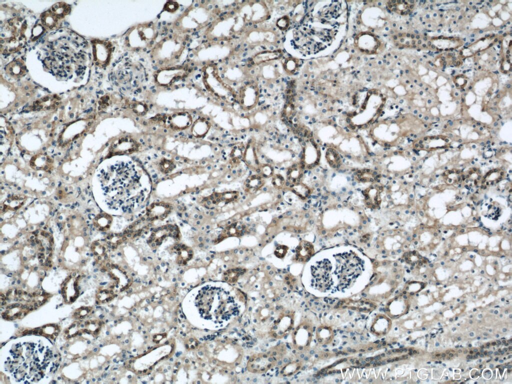 IHC staining of human kidney using 10479-2-AP