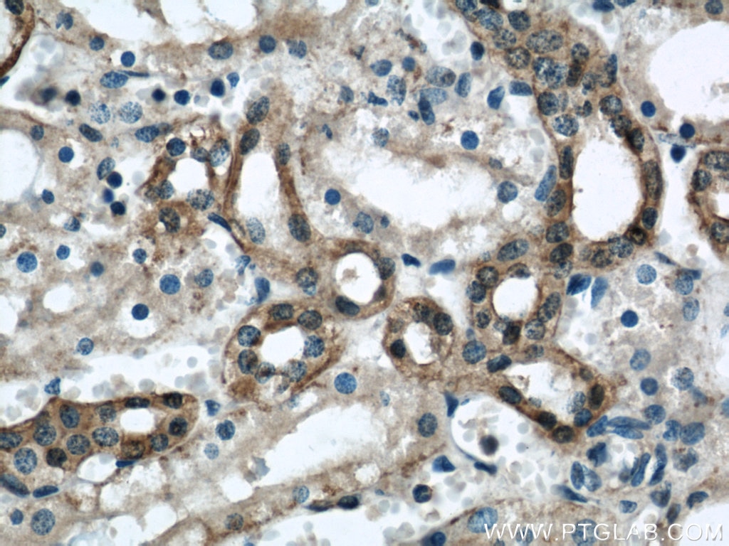 Immunohistochemistry (IHC) staining of human kidney tissue using Annexin A11 Polyclonal antibody (10479-2-AP)