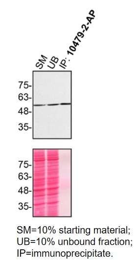 Immunoprecipitation (IP) experiment of HeLa cells using Annexin A11 Polyclonal antibody (10479-2-AP)
