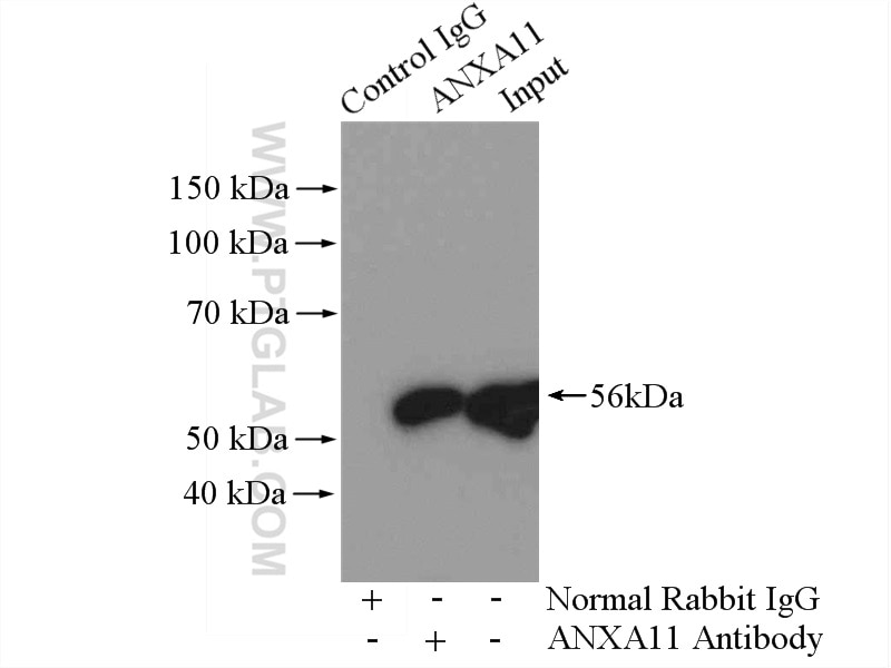 Immunoprecipitation (IP) experiment of HeLa cells using Annexin A11 Polyclonal antibody (10479-2-AP)