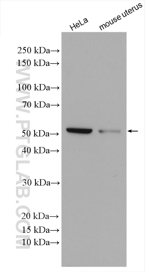Western Blot (WB) analysis of various lysates using Annexin A11 Polyclonal antibody (10479-2-AP)