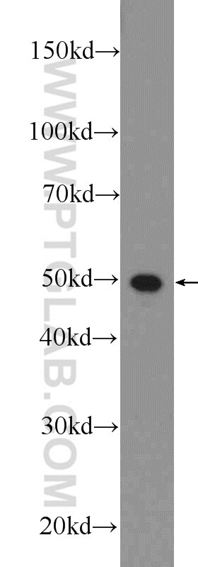 Western Blot (WB) analysis of rat uterus tissue using Annexin A11 Polyclonal antibody (10479-2-AP)