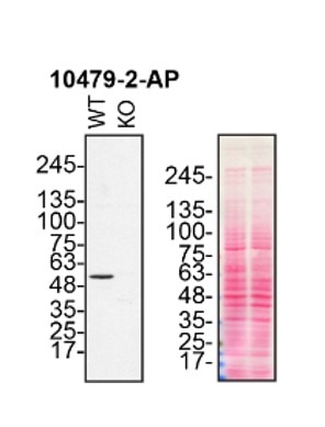 Western Blot (WB) analysis of HeLa cells using Annexin A11 Polyclonal antibody (10479-2-AP)