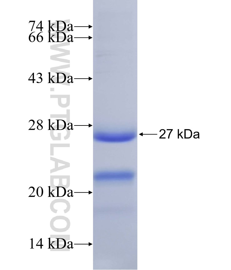 ANXA11 fusion protein Ag31839 SDS-PAGE