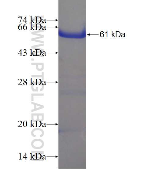 ANXA13 fusion protein Ag18581 SDS-PAGE