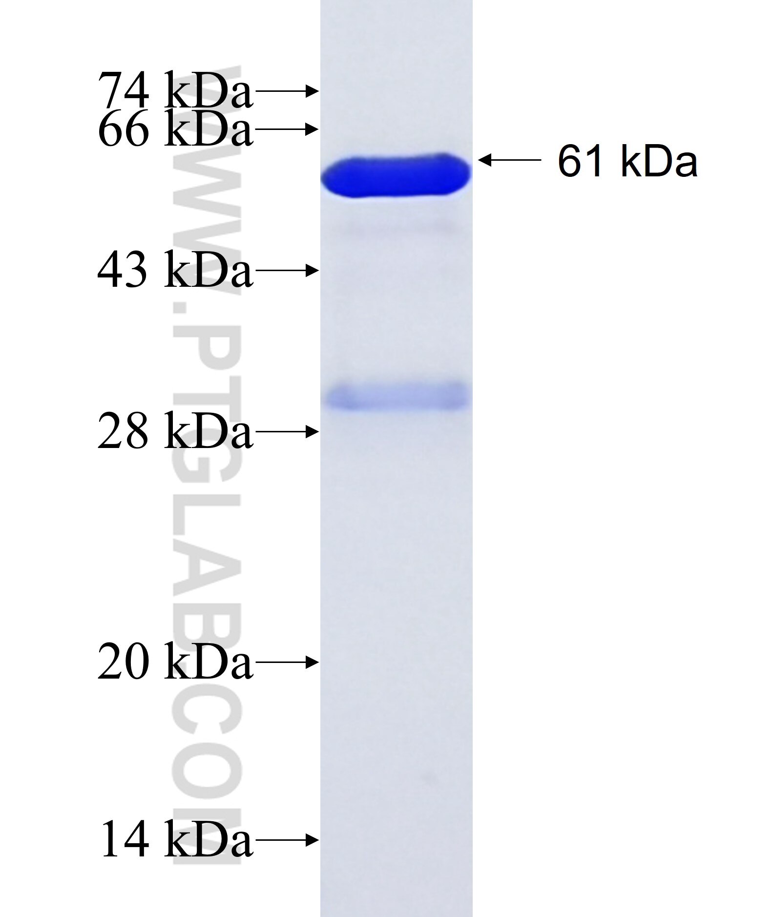 ANXA13 fusion protein Ag18581 SDS-PAGE