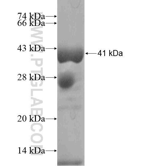 ANXA13 fusion protein Ag18679 SDS-PAGE