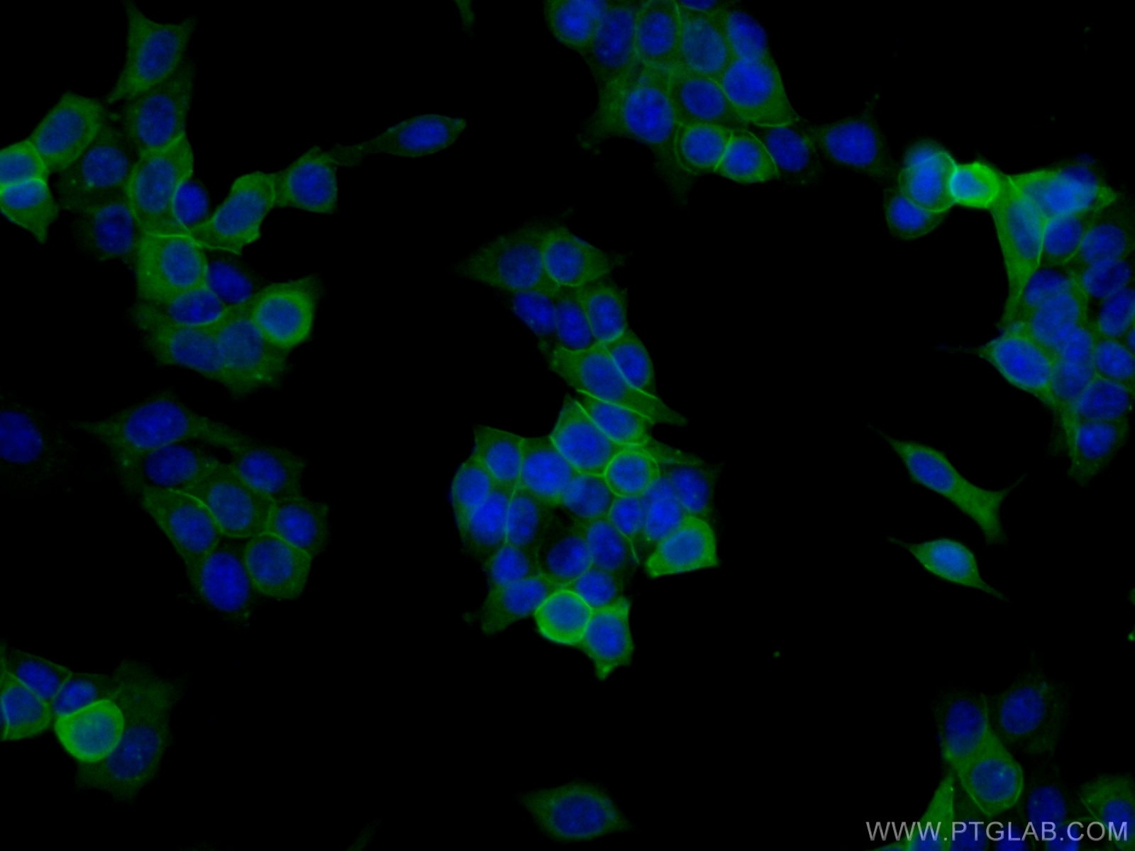 Immunofluorescence (IF) / fluorescent staining of MCF-7 cells using Annexin A2 Polyclonal antibody (11256-1-AP)